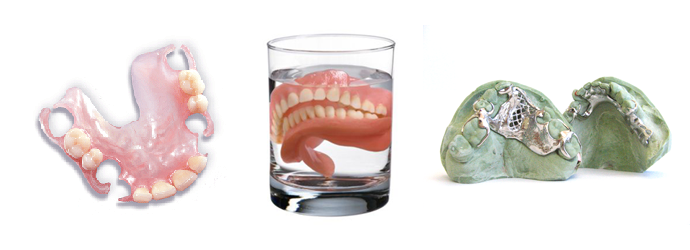 Dentures, Partial-Dentures, and Frameworks